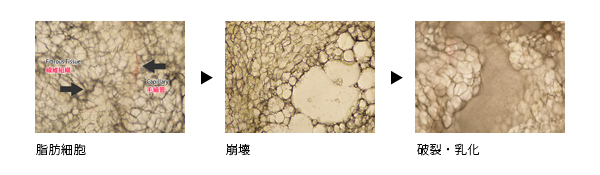 キャビテーション